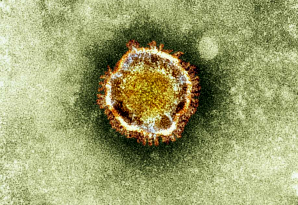 Le nouveau coronavirus a affecté depuis septembre dernier 44 personnes, dont 22 sont décédées.