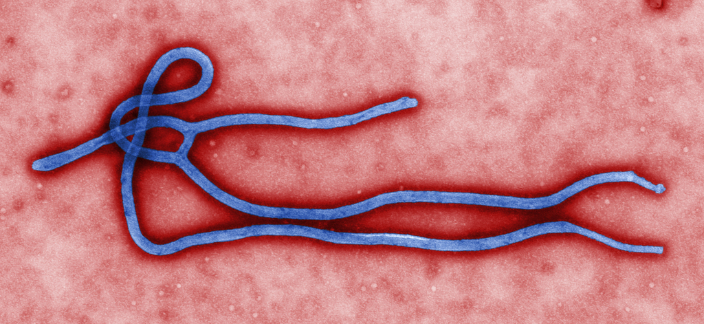 Le séquençage du génome de 99 virus Ebola par des chercheurs américains a permis de donner un nouvel éclairage sur l'origine de l'épidémie actuelle.