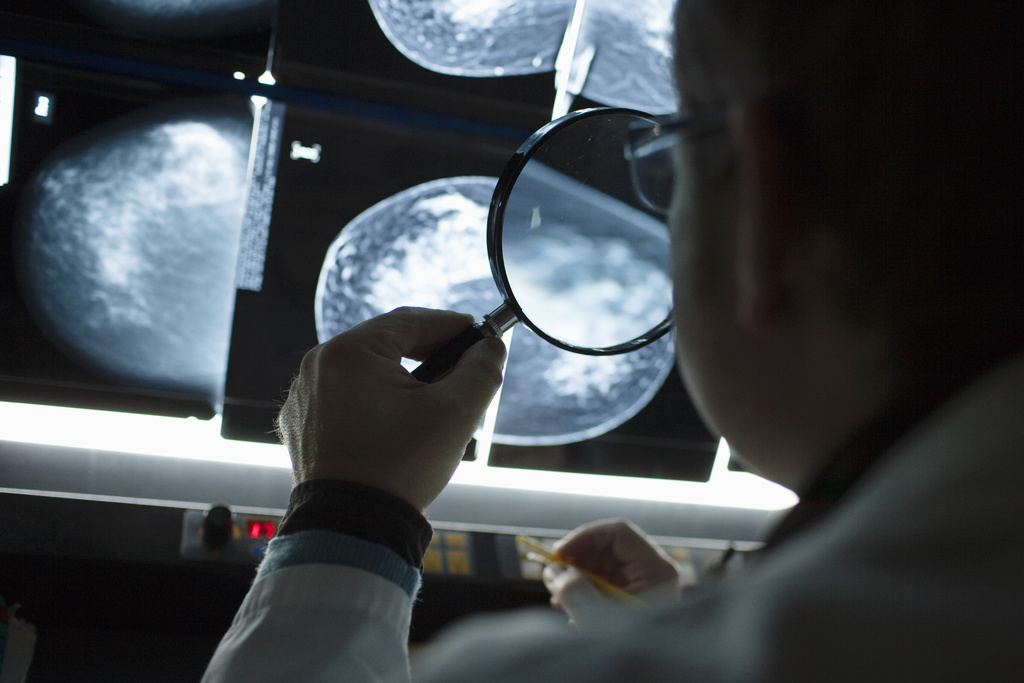 Selon les membres du projet SBra, la mammographie est le moyen de dépistage le plus efficace et le plus reconnu scientifiquement, mais elle demeure onéreuse. (Illustration)