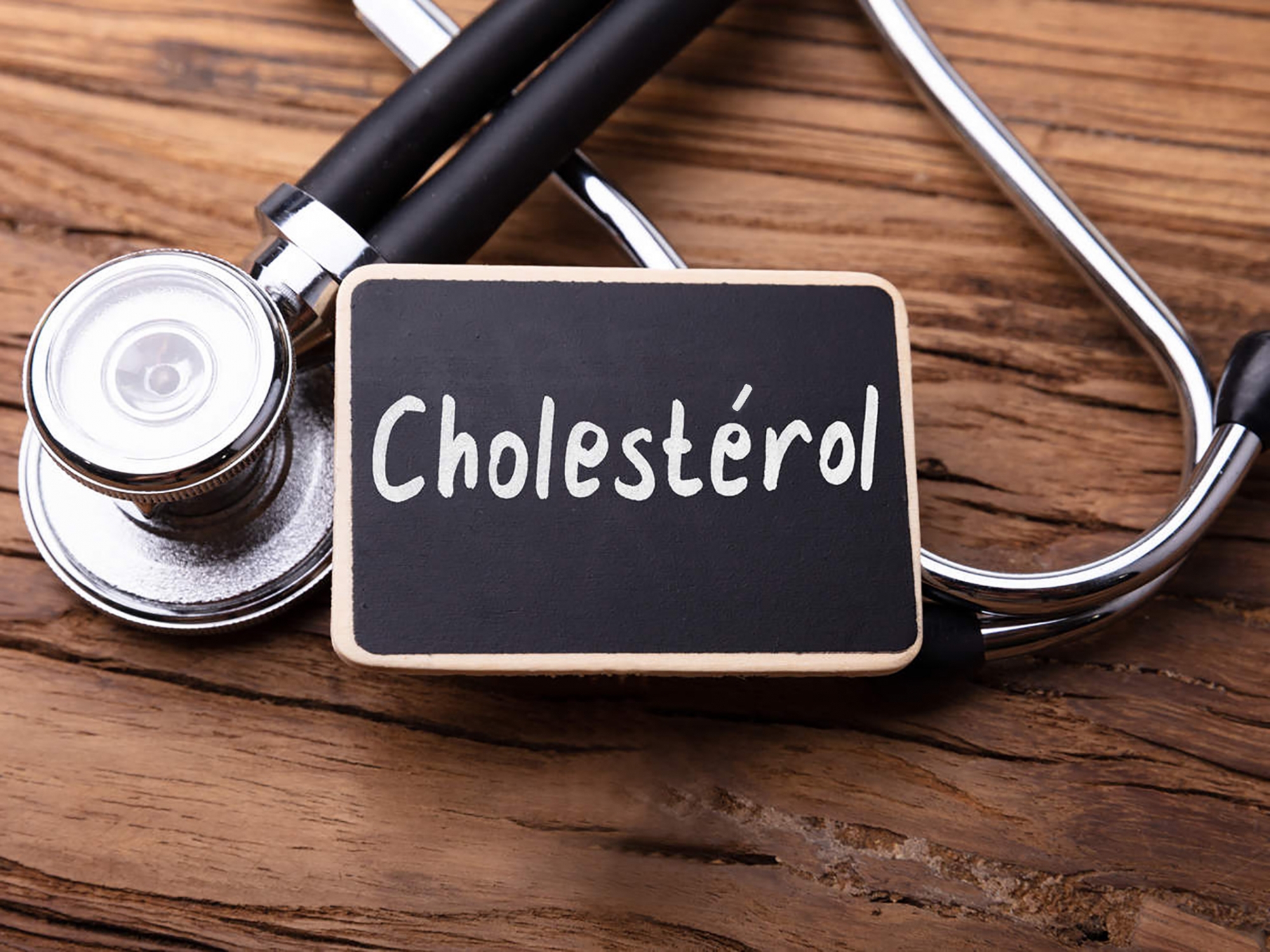 P28_cholesterol